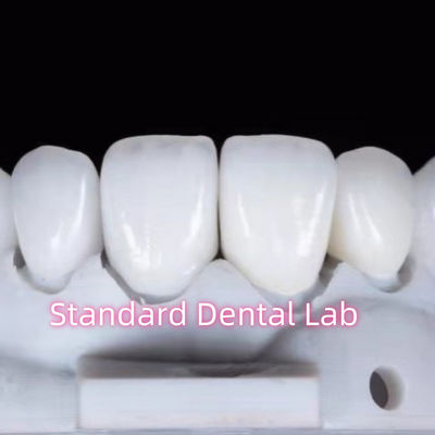 Restaurazioni dall'aspetto naturale Dental Aidite Zirconia Corona dentale