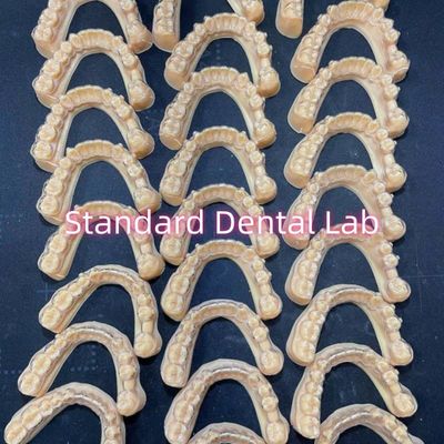 Dentisti professionisti ortodontici Invisalign Clear Retainers Piano di trattamento