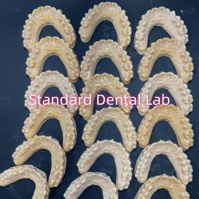Ritenibili ortodontici invisalign trasparenti