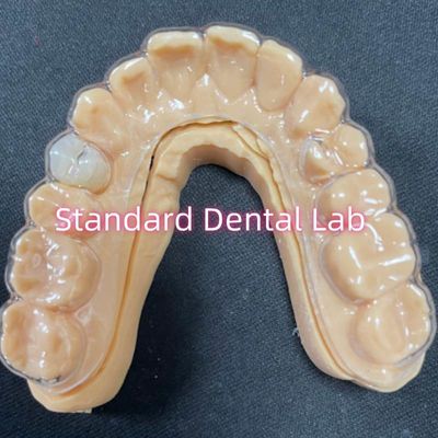 Ritenitori ortodontici professionali Ritenitori Essix trasparenti con denti in resina acrilica stabile