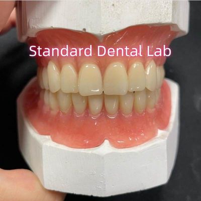 Denti parziali acrilici denti ivoclari gomma rosa