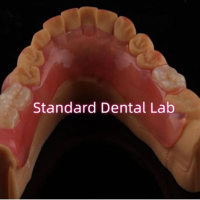 Protesi parziale Valplast flessibile di alta estetica facile da pulire