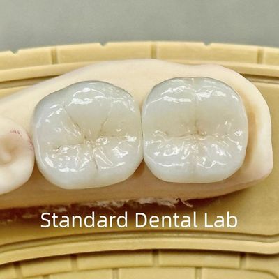 Corone di laboratorio dentale di zirconia trasparente e di grande resistenza
