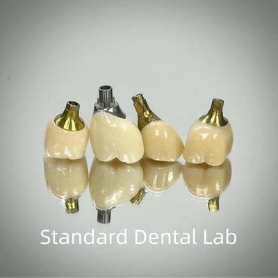Professionale di zirconia vite Implantazione mantenuta corona di titanio CAD CAM
