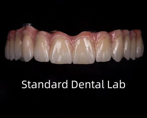 Titanio pieno di zirconia ponte translucide dentale sulla barra di impianto