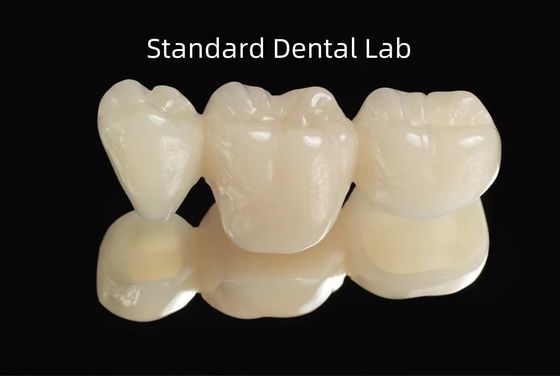 CAD CAM PMMA vuoto ponte temporaneo dentale provvisorio