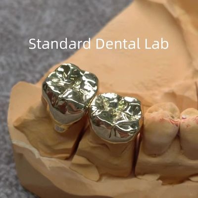 Corone d'oro dentistiche gialle di alto Nobel
