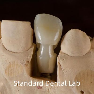 Impianto dentale Tibase Abutment di zirconia Titanio Precisione personalizzata