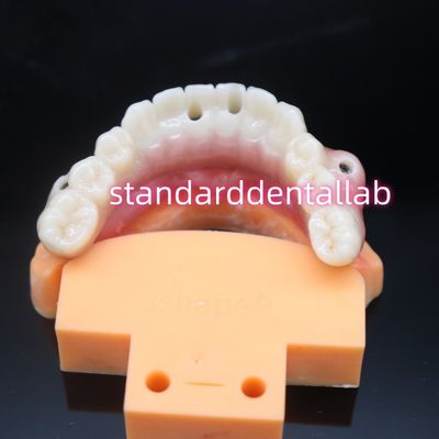 Ponte per impianti dentali in zirconia color dente biocompatibile
