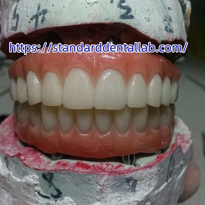 Impianto dentale Corona temporanea ponte PMMA con porcellana rosa