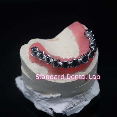 Full Arch Malo Bridge Restauro dentale Coroe di zirconia con gomma Poecelian China Dental Lab