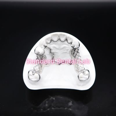 Dentatura parziale stampata Scheftner Metallo Cornice Dentatura parziale precisa Customized Cast