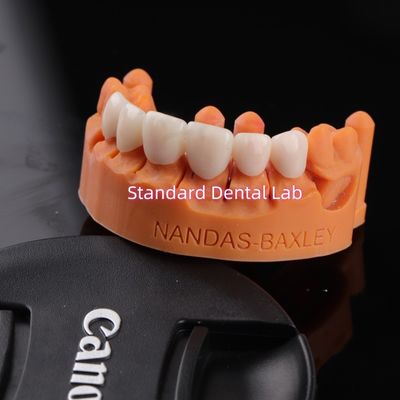 Comfort e funzionalità con Digital CAD CAM Dental Lab Traslucido Ponte in zirconia stratificata