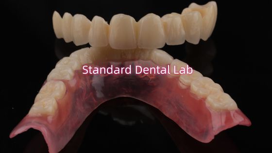 Porcellana stratificata altamente resistente e dall'aspetto naturale per dentale stratificato