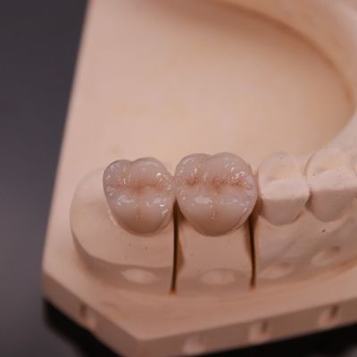 Confortevole corona di zirconia con finitura estetica precisa Express 3-4 giorni Tempo di consegna