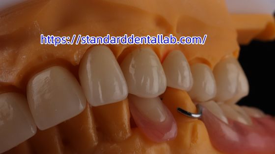 Corona dentale a strati in zirconia e ponte di traslucidità 3D PRO corona di porcellana in zirconia