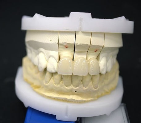 Ponte di corona in zirconia di precisione Comodo / estetica 3-4 giorni Tempo di consegna rapido