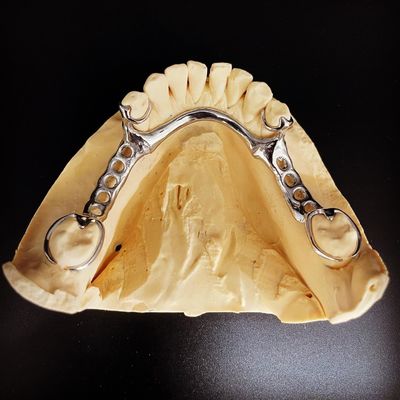Quadro di protesi parziali in metallo Co-Cr per dentisti