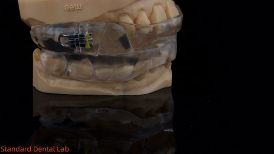 Dispositivo personalizzabile per il sonno dorsale Dispositivo anti russare per un sonno riposante Laboratorio dentale cinese