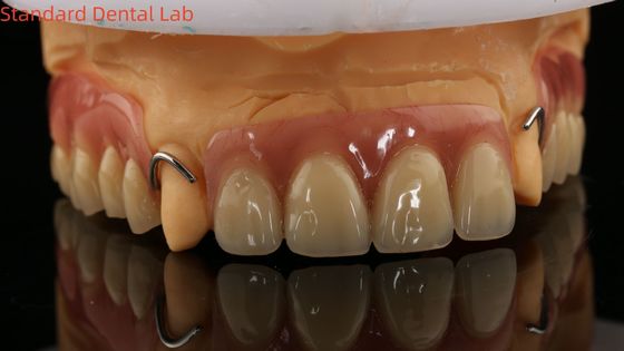 Dentiera parziale di acrilico con cura termica Laboratorio dentale di alta precisione con modello di stampa 3D