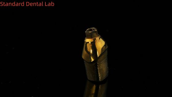 Abutments in titanio puro, la soluzione perfetta per la restaurazione dentale