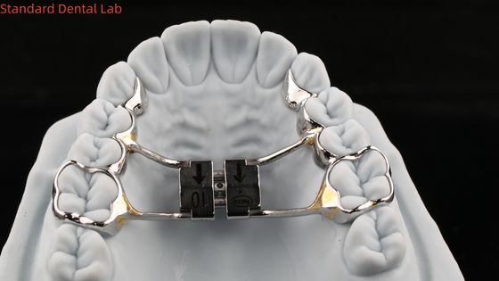 Espansione del palato con arco di denti Stabile Hyrax Espansione del palato perfetta adattazione SDL Apparecchio di ortodonzia di laboratorio dentale