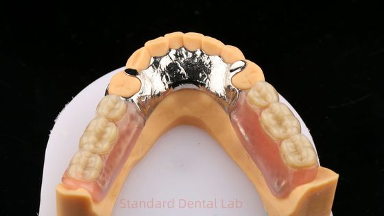 Leghe di metallo Cobalto Cromo Dentiera parziale Ivoclar Scheftner Confortevole Cornice in metallo fuso