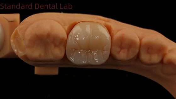 Dental Digital Full Zirconia Crown con Noritake Porcellana 3D Print Model 5 anni di garanzia