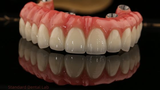 Impianti di zirconia a arco pieno ponte di zirconia corona vita ombra personalizzata tutti su quattro / sei impianti dentali
