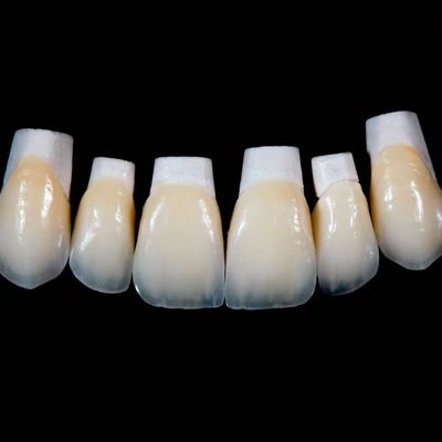 Corone di finiture di porcellana Emax ad alta traslucidità con materiali migliori di Ivoclar Vivadent
