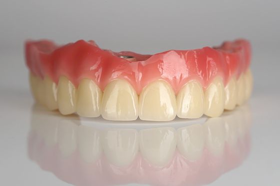 Ponte di impianto circonico a arco pieno All-on-four / All-on-six Impianti dentali Ricostruzione rapida