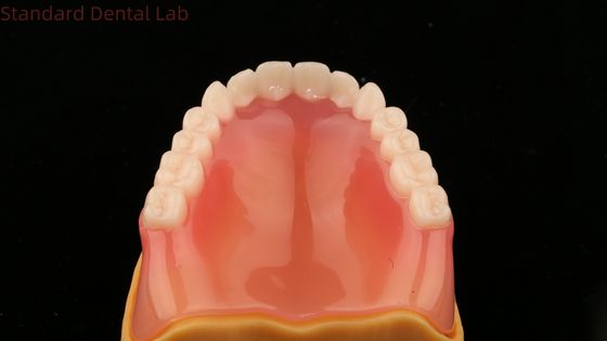 Protesi dentale completa Ivoclar Protesi dentale completa Acrilica Denti SDL Dental Lab