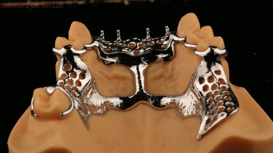 Fabbricazione a base di metalli acrilici