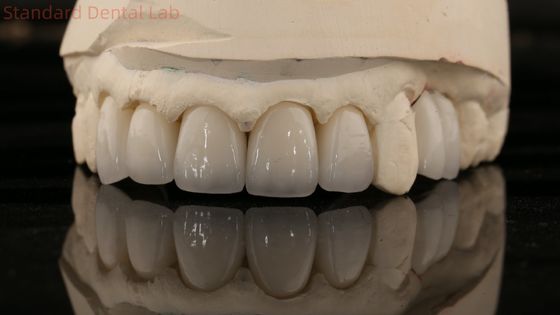 Cina Dental Lab Zirconia Full Contour Crown High Aesthetic Natural Dental Bridge 5 anni di garanzia