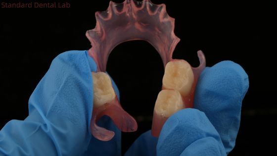 Dental TCS Valplast Flessibili protesi parziali Nesbit Valplast Finish Cina Valplast di laboratorio dentale