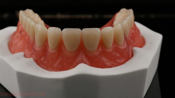 Dentsply Lucitone 199 Protesi acrilica per un aspetto naturale a arco intero