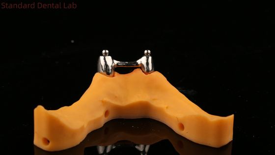 Ivoclar Digital Dental Implant Bar Denture con Appendici, Denture a Titanio Acrilico