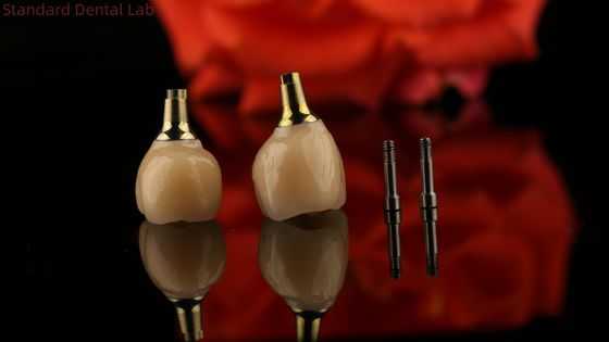 Impianto a vite di porcellana circonia cemento trattenuto Forma di testa esagonale per estetica personalizzata