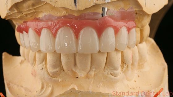 Buona vestibilità Precise Esthetic Zirconia Porcellana Corona Rosa Porcellana Con Sfumatura Sbiancatrice
