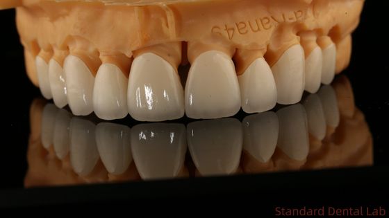 Corone di laboratorio dentale a contorno completo di alta traslucidità Corone di zirconia solida