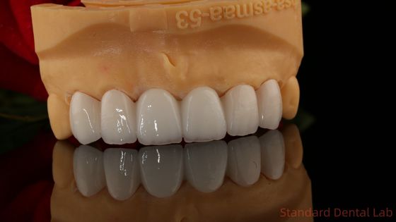 Corone di zirconia a contorno completo traslucidità 3D PRO senza rivestimento in porcellana Laboratorio dentale standard