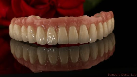 Impianti dentali in zirconia titanio tutti su 4 denti a arco completo Sostituzione 3-6 mesi Tempo di guarigione