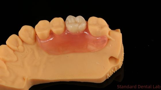 Dental TCS Valplast Flessibili protesi parziali Nesbit Valplast Finish Cina Valplast di laboratorio dentale