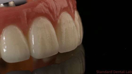 Impianto dentale di zirconio professionale Corona di titanio CAD CAM Corona di zirconio Laboratorio dentale cinese