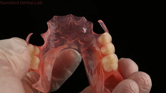 Denti d'Asso Rosa/Oscuro TCS Valplast Protesi parziali flessibili per alta estetica Modello di stampa 3D dentale