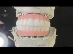 Porcellana tutto su quattro Ponte di zirconia Ponte di impianti dentali di alta estetica