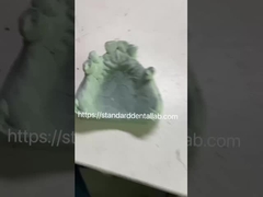 Quadro di protesi parziali in metallo Co-Cr per dentisti