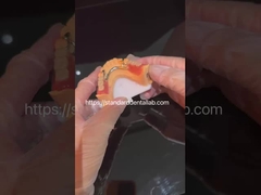 Protesi parziale acrilica ad alta estetica con chiusura trasparente e denti acrilici China Dental Lab