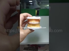 Alto estetico BruxZir Full Contour Zirconia Crowns PFZ Ponte