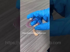 Alta estetica dentale TCS Valplast flessibile protesi parziali Dental Lab rosa